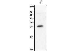 Western blot analysis of RGS18 using anti-RGS18 antibody (ABIN7599123).