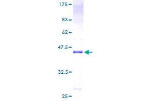 Image no. 1 for Nuclear Factor of Activated T-Cells, Cytoplasmic, Calcineurin-Dependent 2 Interacting Protein (NFATC2IP) (AA 1-138) protein (GST tag) (ABIN1312445)