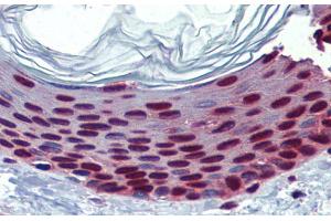 Immunohistochemistry with Human Skin lysate tissue at an antibody concentration of 5.