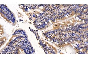 Detection of a2M in Porcine Small intestine Tissue using Polyclonal Antibody to Alpha-2-Macroglobulin (a2M)