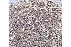 IHC analysis of NOLA1/GAR1 using anti-NOLA1/GAR1 antibody (ABIN7602076). (GAR1 anticorps  (AA 58-165))