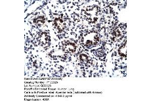 Human Lung (GABPB2 anticorps  (C-Term))
