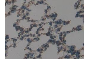Detection of GATA4 in Rat Lung Tissue using Polyclonal Antibody to GATA Binding Protein 4 (GATA4)