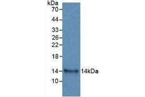 Detection of Recombinant IL33, Human using Monoclonal Antibody to Interleukin 33 (IL33)