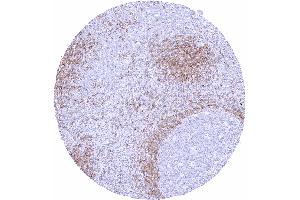 Tonsil Strong IgD staining in a fraction of B lymphocytes especially in the mantle zone (Recombinant IgD anticorps)
