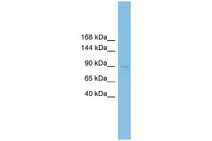 XRRA1 antibody used at 1 ug/ml to detect target protein. (XRRA1 anticorps  (N-Term))