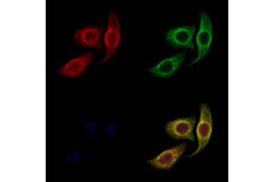 ABIN6257673 and ABIN6274842 staining Hela cells by IF/ICC.