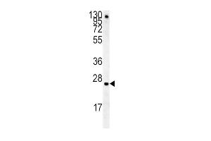 Western blot analysis in mouse lung tissue lysates (15ug/lane). (IGFBP4 anticorps  (AA 96-124))