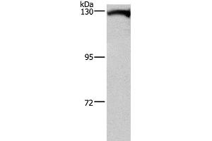 Western Blot analysis of Human testis tissue using DAAM1 Polyclonal Antibody at dilution of 1:400 (DAAM1 anticorps)