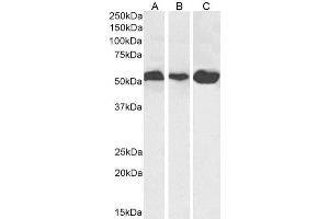 Western Blot using anti-Alpha-Tubulin antibody F2C. (Recombinant alpha Tubulin anticorps)
