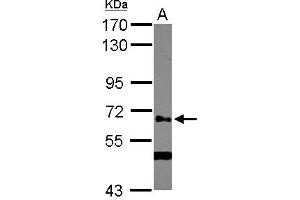 Western Blotting (WB) image for anti-UDP-N-Acetyl-alpha-D-Galactosamine:polypeptide N-Acetylgalactosaminyltransferase 14 (GalNAc-T14) (GALNT14) (AA 1-189) antibody (ABIN1498369) (GALNT14 anticorps  (AA 1-189))