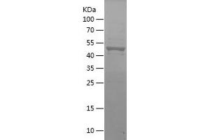 Western Blotting (WB) image for Forkhead Box P3 (FOXP3) (AA 2-249) protein (His-IF2DI Tag) (ABIN7122996) (FOXP3 Protein (AA 2-249) (His-IF2DI Tag))