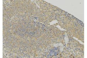 ABIN6272897 at 1/100 staining Human lymph node tissue by IHC-P.