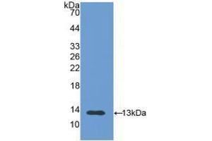 Western blot analysis of recombinant Human PIGR. (PIGR anticorps  (AA 19-120))