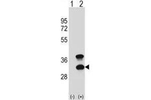 Western blot analysis of CD79b antibody and 293 cell lysate (2 ug/lane) either nontransfected (Lane 1) or transiently transfected (2) with the CD79B gene. (CD79b anticorps  (AA 93-121))