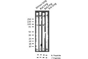 Western blot analysis of Phospho-VAV1 (Tyr174) expression in various lysates