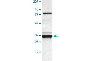 Western Blot (Cell lysate) analysis of human cell line RT-4 with GNPDA1 polyclonal antibody  at 1:250 - 1:500 dilution. (GNPDA1 anticorps)