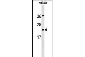 PDCD6 Antibody (N-term) (ABIN1881643 and ABIN2838873) western blot analysis in A549 cell line lysates (35 μg/lane).