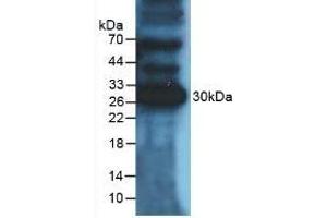 Detection of PDL1 in Mouse Heart Tissue using Polyclonal Antibody to Programmed Cell Death Protein 1 Ligand 1 (PDL1) (PD-L1 anticorps  (AA 48-290))