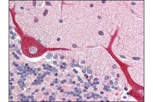 Image no. 1 for anti-Interleukin 23, alpha subunit p19 (IL23A) (N-Term) antibody (ABIN303269) (IL23A anticorps  (N-Term))