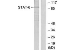 Western Blotting (WB) image for anti-Signal Transducer and Activator of Transcription 6, Interleukin-4 Induced (STAT6) (AA 612-661) antibody (ABIN2889070) (STAT6 anticorps  (AA 612-661))