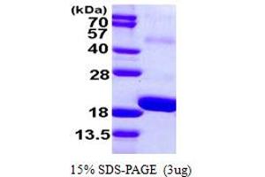SDS-PAGE (SDS) image for Smad Nuclear Interacting Protein 1 (SNIP1) (AA 258-396) protein (His tag) (ABIN667459)