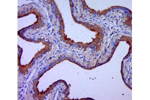 Paraformaldehyde-fixed, paraffin embedded rat bladder, Antigen retrieval by boiling in sodium citrate buffer (pH6.