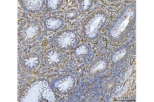 IHC analysis of PTRF/CAVIN1 using anti-PTRF/CAVIN1 antibody (ABIN7601817). (PTRF anticorps  (AA 47-390))