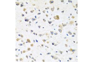 Immunohistochemistry of paraffin-embedded mouse brain using PGR antibody at dilution of 1:100 (x40 lens). (Progesterone Receptor anticorps)