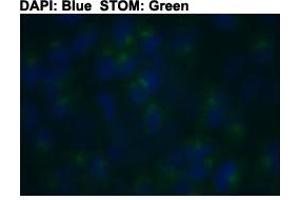 Immunofluorescent staining of HeLa cells with STOM polyclonal antibody  at 1:150 dilution. (Stomatin anticorps  (C-Term))