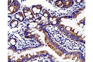 Immunohistochemistry analysis of paraffin-embedded rat colon using MMP2 Polyclonal Antibody at dilution of 1:500. (MMP2 anticorps)