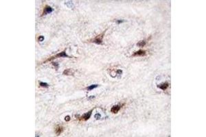 IHC analysis of FFPE human brain tissue stained with NURR1 antibody (NR4A2 anticorps  (AA 13-42))