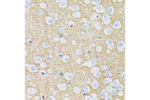 Immunohistochemistry of paraffin-embedded rat brain using SLC1A2 antibody (ABIN2736671) at dilution of 1:100 (40x lens). (SLC1A2 anticorps)