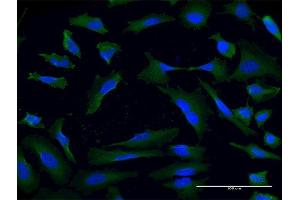 Immunofluorescence of monoclonal antibody to USP9X on HeLa cell. (USP9X anticorps  (AA 1-90))