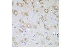 Immunohistochemistry of paraffin-embedded mouse brain using TMOD3 antibody. (TMOD3 anticorps)