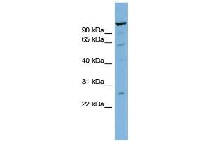 WB Suggested Anti-C6orf10 Antibody Titration:  0. (CDNA Sequence BC051142 (BC051142) (Middle Region) anticorps)