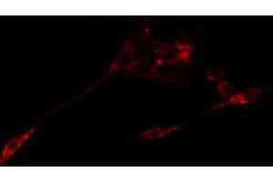 ABIN6274766 staining Hela cells by IF/ICC. (RPL10L anticorps  (C-Term))