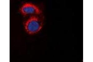 Immunofluorescent analysis of mPR alpha staining in A549 cells. (PAQR7 anticorps  (C-Term))
