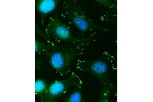 anti-Quiescin Q6 Sulfhydryl Oxidase 2 (QSOX2) (AA 102-523) antibody