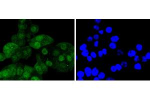 SW480 cells were stained with Cdk6 (4F7) Monoclonal Antibody  at [1:200] incubated overnight at 4C, followed by secondary antibody incubation, DAPI staining of the nuclei and detection.