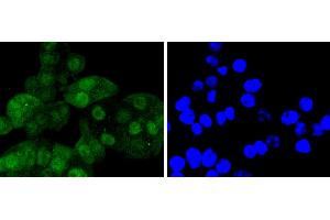 SW480 cells were stained with Cdk6 (4F7) Monoclonal Antibody  at [1:200] incubated overnight at 4C, followed by secondary antibody incubation, DAPI staining of the nuclei and detection. (CDK6 anticorps)