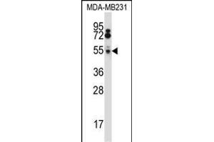 HTRA2 Antibody (N-term) (ABIN657628 and ABIN2846624) western blot analysis in MDA-M cell line lysates (35 μg/lane). (HTRA2 anticorps  (N-Term))