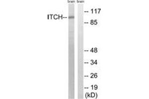 Western blot analysis of extracts from mouse brain cells, using ITCH (Ab-420) Antibody. (ITCH anticorps  (AA 386-435))
