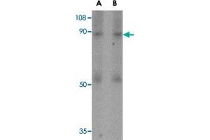 Western blot analysis of CD248 in human colon tissue lysate with CD248 polyclonal antibody  at (A) 0. (CD248 anticorps  (N-Term))