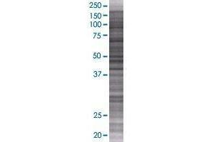 IBTK transfected lysate. (IBTK 293T Cell Transient Overexpression Lysate(Denatured))