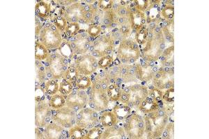 Immunohistochemistry of paraffin-embedded mouse kidney using SMAD9 antibody (ABIN5975592) at dilution of 1/100 (40x lens). (SMAD9 anticorps)
