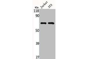 Western Blot analysis of Jurkat NIH-3T3 cells using MMP-2 Polyclonal Antibody