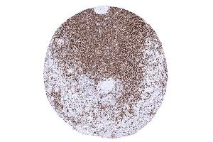 The vast majority of splenic lymphocytes of the white pulp of the spleen are CD45RA positive (CD45RA anticorps)