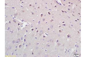Formalin-fixed and paraffin embedded rat brain labeled with Anti CROT Polyclonal Antibody, Unconjugated (ABIN708896) at 1:200 followed by conjugation to the secondary antibody and DAB staining (CROT anticorps  (AA 41-140))