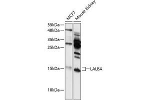 Western blot analysis of extracts of various cell lines, using LALBA antibody (ABIN6130518, ABIN6143065, ABIN6143066 and ABIN6216420) at 1:3000 dilution.